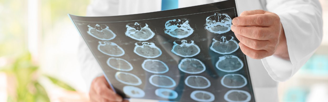 Medico che tiene in mano una lastra di risonanza magnetica del cervello nell’ambito di una visita neurologica
