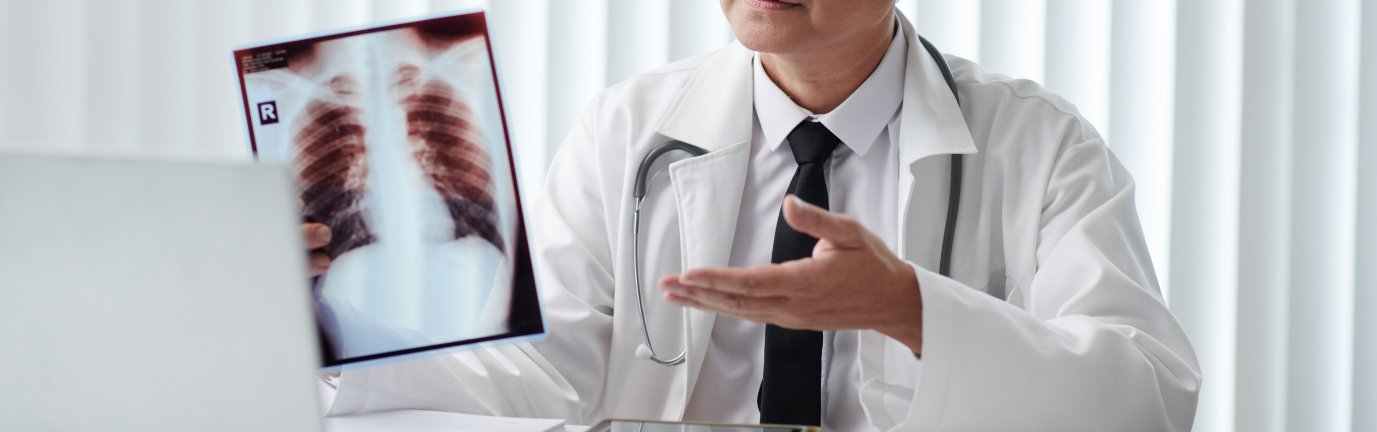 Medico mostra una radiografia durante una visita pneumologica
